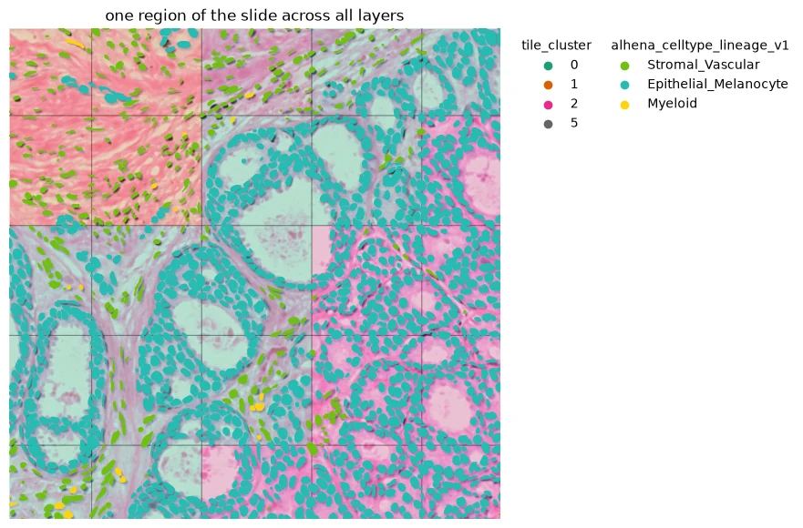 One region of the slide with H&E, tile clusters, and cell-type annotations