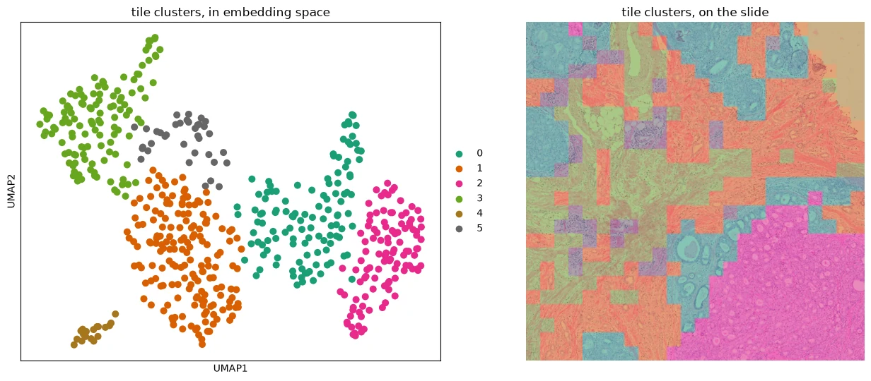 Tile embedding clusters in the UMAP of the tile embeddings and on the H&E