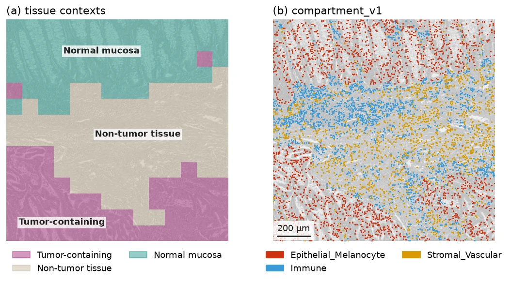 A field of slide BRAF_094_CT_CBM_P1 shown twice, with its cohort-derived tissue contexts and with its ALHENA compartment_v1 annotations