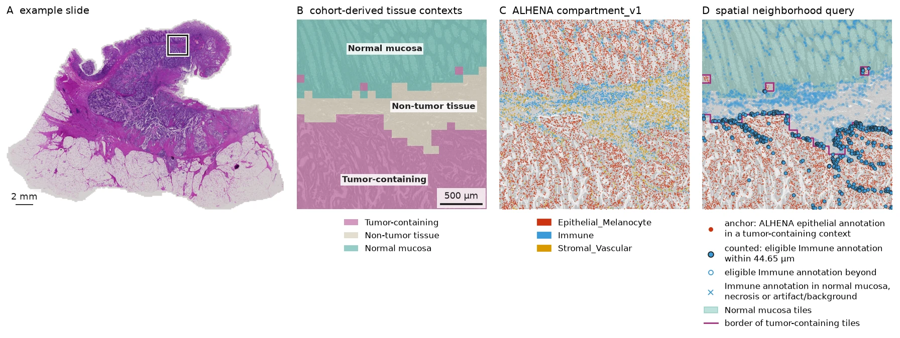 Multi-scale view of slide BRAF_094_CT_CBM_P1, from the whole slide to cohort-derived tissue contexts, ALHENA cell annotations and a spatial neighborhood query