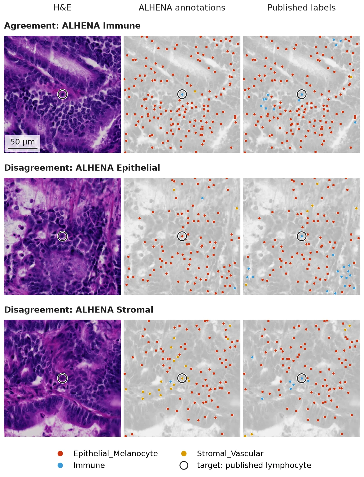 Three fields of slide BRAF_094_CT_CBM_P1, each shown as H&E, with ALHENA compartment_v1 annotations and with the published labels mapped to the same cell type classes